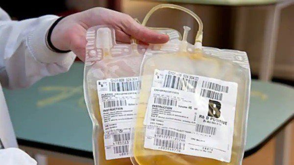 ಯುಪಿ: 'ಮೂಸಂಬಿ ಜ್ಯೂಸ್' ಸಾವಿನ ಪ್ರಕರಣ: 'ನಕಲಿ' ರಕ್ತದ ಪ್ಲೇಟ್‌ಲೆಟ್‌ ಮಾರಾಟ- 10 ಬಂಧನ