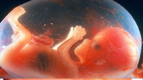 Embryo Freezing: ಘನೀಕೃತ ಭ್ರೂಣಗಳಿಂದ ಮಗು ಹೇಗೆ ಹುಟ್ಟುತ್ತವೆ?