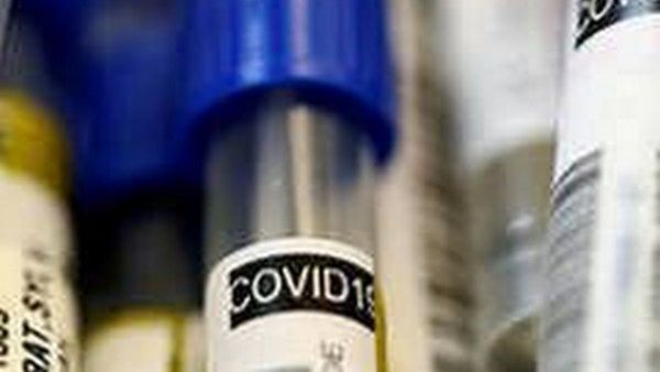 Covid 19 Report: ಭಾರತದಲ್ಲಿ 10,542 ಪಾಸಿಟಿವ್ ಪ್ರಕರಣ ಪತ್ತೆ, ಎರಡೇ ದಿನದಲ್ಲಿ ಶೇ.38 ಏರಿಕೆ