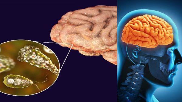 ಇಲ್ಲಿನ ಕೆರೆಗಳಲ್ಲಿ ಈಜಾಡಿದರೆ ಸಾವು ಗ್ಯಾರಂಟಿ: ಯಾಕೆ ಗೊತ್ತಾ?