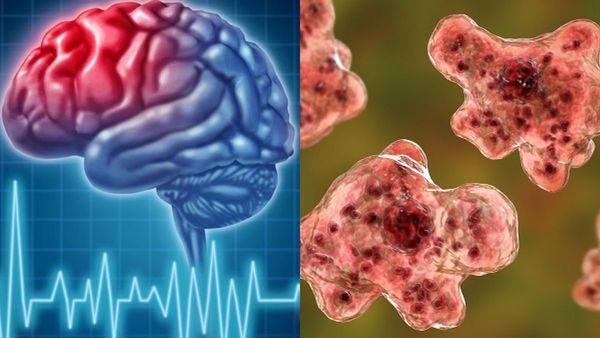 ಪಾಕಿಸ್ತಾನದಲ್ಲಿ ಮತ್ತೆ ಇಬ್ಬರ ಮೆದುಳು ತಿಂದ ಹುಳು!