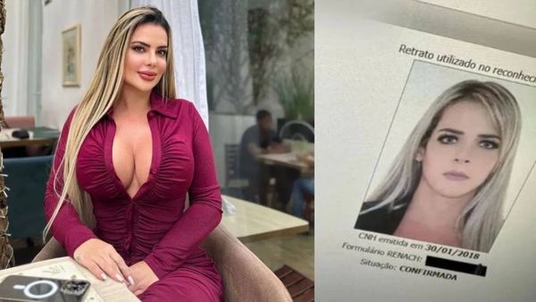 2.5 ಕೋಟಿ ರೂಪಾಯಿಯ ಪ್ಲಾಸ್ಟಿಕ್ ಸರ್ಜರಿ ಮಾಡಿಸಿಕೊಂಡಾಕೆಗೆ ಡ್ರೈವಿಂಗ್ ಲೈಸೆನ್ಸ್ ನವೀಕರಣಗೊಳಿಸಲಾಗಲಿಲ್ಲ....