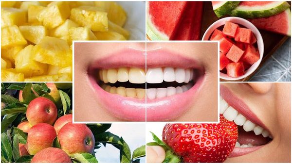 Dental Care Tips: ಹಲ್ಲಿನ ಆರೋಗ್ಯ ಕಾಪಾಡುವ ಹಣ್ಣುಗಳು ಇವು... ತಿಂದು ನೋಡಿ... 