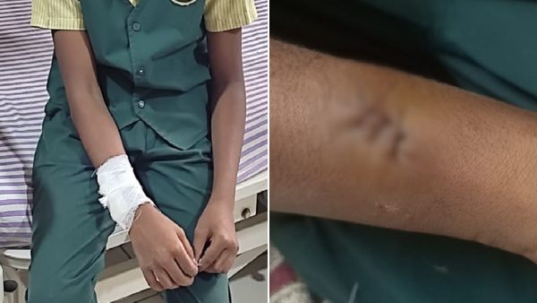 ಬೆಂಗಳೂರು: ಹೋಮ್​ ವರ್ಕ್​​ ಮಾಡಿಲ್ಲವೆಂದು ಬಾಲಕನಿಗೆ ರಾಡ್​ನಿಂದ ಮನಸೋಇಚ್ಛೆ ಹೊಡೆದ ಶಿಕ್ಷಕಿ