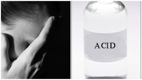 Acid Attack: ಕಡಬದಲ್ಲಿ ಮೂವರು ವಿದ್ಯಾರ್ಥಿನಿಯರ ಮೇಲೆ ಆ್ಯಸಿಡ್ ದಾಳಿ