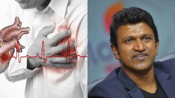 'ಡಾ.ಪುನೀತ್ ರಾಜ್ ಕುಮಾರ್ ಹೃದಯ ಜ್ಯೋತಿ' ಯೋಜನೆಗೆ ಇಂದು ಚಾಲನೆ: ಅಂಶಗಳು