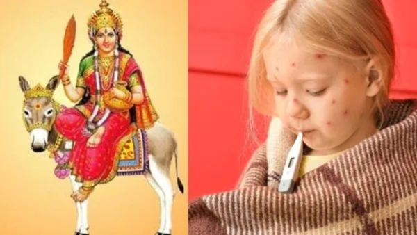 Chicken Pox: ಭಾರತದಲ್ಲಿ ಚಿಕನ್ ಪಾಕ್ಸ್ ಅನ್ನು 'ಅಮ್ಮಾ' ಎಂದು ಏಕೆ ಕರೆಯುತ್ತಾರೆ?