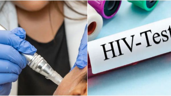 Facial: ಫೇಶಿಯಲ್ ಮಾಡಿಸಿಕೊಂಡ 3 ಮಹಿಳೆಯರಲ್ಲಿ HIV ಪಾಸಿಟಿವ್