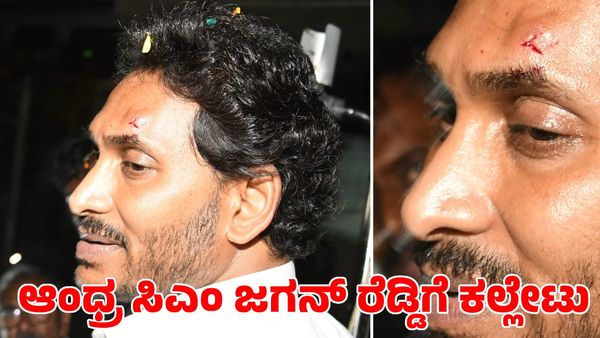 Jagan Mohan Reddy: ಪ್ರಚಾರದ ವೇಳೆ ಕಲ್ಲುತೂರಾಟದಲ್ಲಿ ಗಾಯಗೊಂಡ ಆಂಧ್ರ ಪ್ರದೇಶ ಸಿಎಂ ಜಗನ್‌ ರೆಡ್ಡಿ