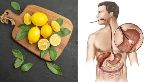Lemon Side Effects: ಈ ಸಮಸ್ಯೆ ಇರುವವರು ತಿಳಿಯದೆ ನಿಂಬೆಹಣ್ಣನ್ನು ಬಳಸಬಾರದು... ಇಲ್ಲದಿದ್ದರೆ ಅಪಾಯ!