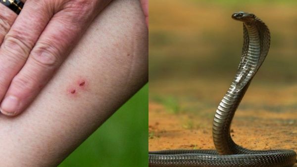Snakebite: ಪ್ರತಿ ವರ್ಷ ಹಾವು ಕಡಿತದಿಂದ ದೇಶದಲ್ಲಿ 50,000 ಮಂದಿ ಸಾವು