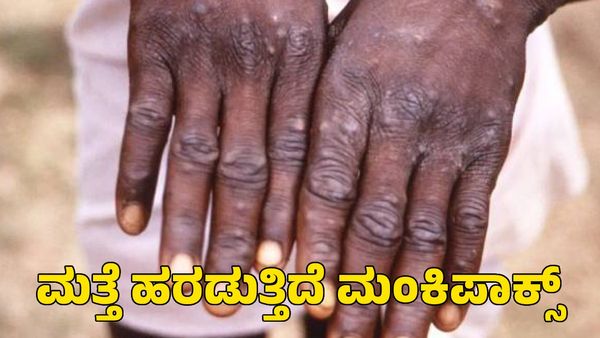 Mpox Outbreak: ಮಂಕಿಪಾಕ್ಸ್ ಉಲ್ಬಣ; ಜಾಗತಿಕ ಆರೋಗ್ಯ ತುರ್ತುಪರಿಸ್ಥಿತಿ ಘೋಷಿಸಿದ ವಿಶ್ವ ಆರೋಗ್ಯ ಸಂಸ್ಥೆ