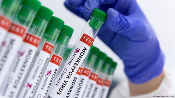 Mpox in India: ಭಾರತದಲ್ಲಿ ಶಂಕಿತ ಎಂಪಾಕ್ಸ್ ಪ್ರಕರಣ ಪತ್ತೆ; ರೋಗಿಯ ಸ್ಥಿತಿ ಹೇಗಿದೆ?