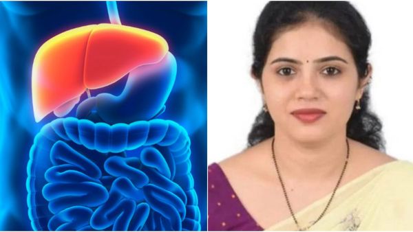 69 ವರ್ಷದ ಹಿರಿಯ ಜೀವ ಉಳಿಸಲು ಯಕೃತ್ ದಾನ ಮಾಡಿ 34 ವರ್ಷದ ಮಹಿಳೆ ಸಾವು