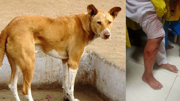 ಹುಬ್ಬಳ್ಳಿಯಲ್ಲಿ 80ಕ್ಕೂ ಹೆಚ್ಚು ಮಂದಿಗೆ ಕಚ್ಚಿದ ಬೀದಿನಾಯಿ, ಕಿಮ್ಸ್‌ಗೆ ದಾಖಲು