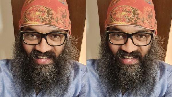 'ಚರ್ಮ ಕಿತ್ತು ರಕ್ತ ಬರುತ್ತಿತ್ತು' ನಿರ್ದೇಶಕ ಗುರು ಪ್ರಸಾದ್‌ಗಿದ್ದ ಆ ಕಾಯಿಲೆ ಯಾವುದು..?