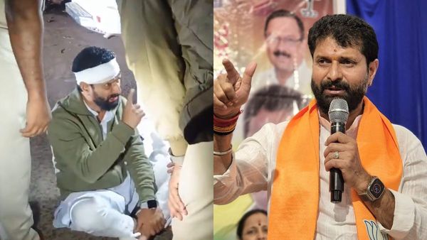 CT Ravi: ತಲೆಯಲ್ಲಿ ರಕ್ತಸ್ರಾವ, ಬ್ಯಾಂಡೇಜ್‌, ಅರೆಸ್ಟ್‌ ಬಳಿಕ ಸಿಟಿ ರವಿಗೆ ಏನಾಯ್ತು?