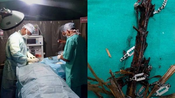 ಬಾಲಕನ ಎದೆಭಾಗಕ್ಕೆ ಇಳಿದ ತೆಂಗಿನ ಗರಿ-ಸರ, ಆಮೇಲೆ ಏನಾಯ್ತು?