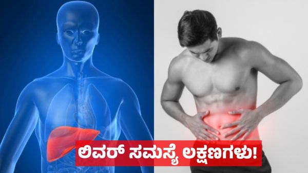 Liver: ಲಿವರ್ ಆರೋಗ್ಯ ಸಮಸ್ಯೆ: ಈ 5 ಮುನ್ಸೂಚನೆ ನಿರ್ಲಕ್ಷಿಸಬೇಡಿ!