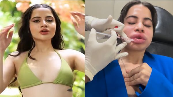 Urfi Javed: ವಿಚಿತ್ರವಾಗಿ ತುಟಿ & ಮುಖ ಊದಿಸಿಕೊಂಡ ಉರ್ಫಿ ಜಾವೇದ್, ಇಲ್ಲಿದೆ ವೈರಲ್ ವಿಡಿಯೋ!