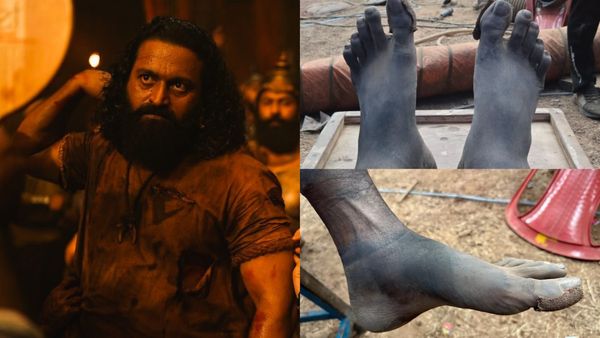 Kantara Chapter 1: ಕ್ಲೈಮ್ಯಾಕ್ಸ್‌ ಶೂಟಿಂಗ್‌‌ ವೇಳೆ ಕಾಲು ಊದಿಕೊಂಡಿತ್ತು: ಕಾಂತಾರದ ಕಷ್ಟ ತೋಡಿಕೊಂಡ ರಿಷಬ್