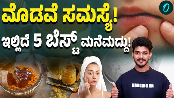 Skin Care Tips: ಮೊಡವೆ ಸಮಸ್ಯೆಗೆ ಇಲ್ಲಿದೆ 5 ಸರಳ ಮನೆಮದ್ದುಗಳು