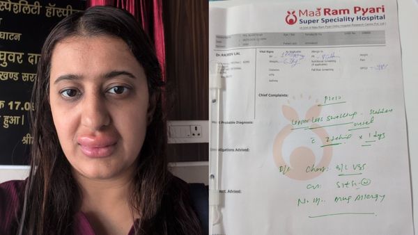 ವಂದೇ ಭಾರತ್ ರೈಲಿನ ಊಟ ಸೇವಿಸಿದ ಮಹಿಳೆಗೆ ತೀವ್ರ ಅಲರ್ಜಿ, 2 ವರ್ಷದ ಮಗನಿಗೆ ಅತಿಸಾರ: IRCTC ಹೇಳಿದ್ದೇನು?