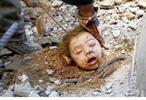 യുഎന്‍ സ്‌കൂളിന്‌ നേരെയും ബോംബാക്രമണം