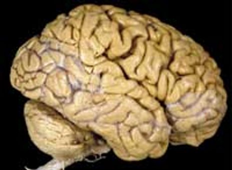 നാര്‍കോ പരിശോധന ശരിയോ?