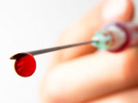 ഭാര്യയ്ക്ക് എച്ച്‌ഐവി രക്തം കുത്തിവച്ചു