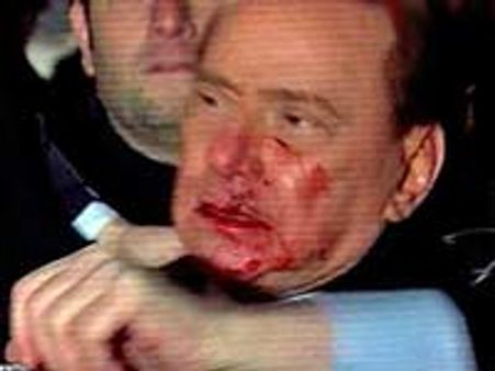 പ്രതിമയേറ് ബെര്‍ലൂസ് കോണിക്ക് പരിക്കേറ്റു