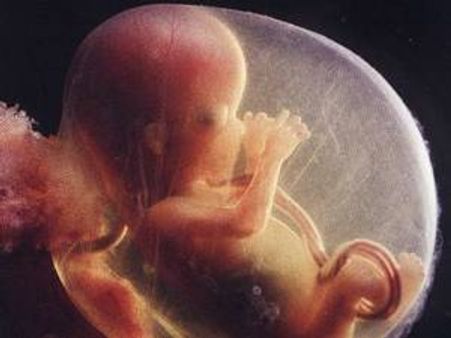 1മാസം പ്രായമായ കുഞ്ഞിന്റെ വയറ്റില്‍ ഭ്രൂണവളര്‍ച്ച