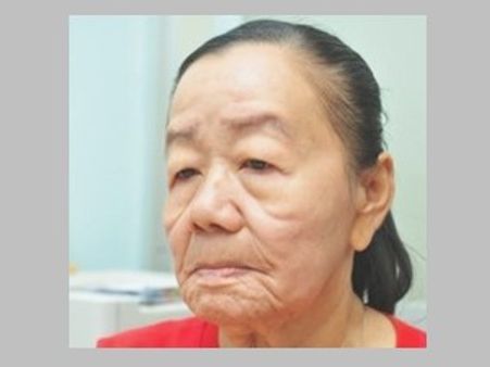 23കാരി ദിവസങ്ങള്‍കൊണ്ട് 50കാരിയായി