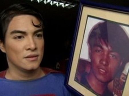 പ്ലാസ്റ്റിക് സര്‍ജറിയിലൂടെ സൂപ്പര്‍ മാനായി!!