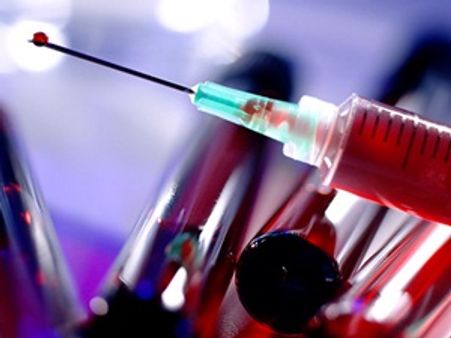 യൗവനം നിലനിര്‍ത്താന്‍ ഡ്രാക്കുള തെറാപ്പി