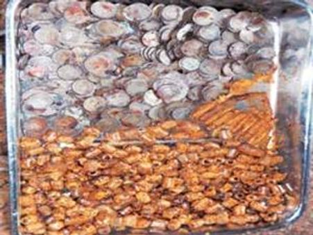 28കാരന്റെ വയറ്റില്‍ 6കിലോ ഇരുമ്പ്