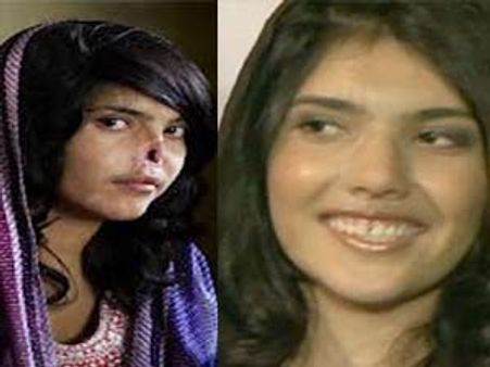 'താലിബാന്‍ ക്രുരതയ്ക്കു' ഒരു പുതിയ മുഖം