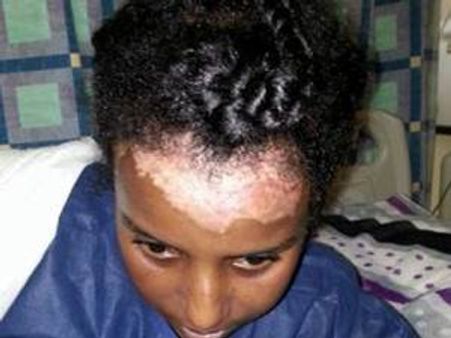 ജോലിക്കാരിയുടെ ദേഹത്ത് തിളച്ച എണ്ണയൊഴിച്ചു