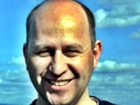 കഷണ്ടി ഹൃദ്രോഗത്തിന്റെ ലക്ഷണം