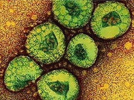 സൗദിയില്‍ മെര്‍സ് വൈറസ്: ലോകാരോഗ്യ സംഘട രംഗത്ത്