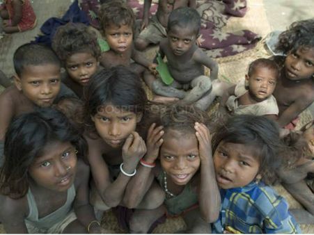 ബാഗംലൂര്‍, പോഷകാഹാരക്കുറവ് 5വയസ്സുകാരി മരിച്ചു