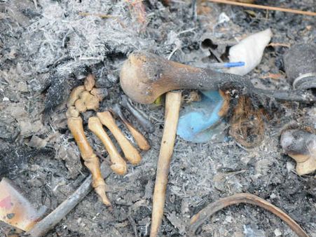 തിരുവനന്തപുരത്ത് മാലിന്യംകത്തിച്ചപ്പോള്‍ അസ്ഥികൂടം