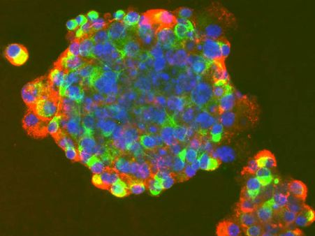 ചര്‍മകോശത്തില്‍ നിന്ന് ഭ്രൂണമുണ്ടാക്കാം