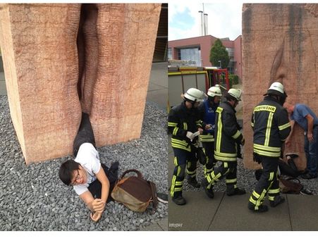 യോനീ നാളത്തില്‍ കുടുങ്ങിയ യുവാവിന്റെ ചിത്രം വൈറലായി