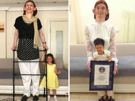 ഏഴടി ഉയരമുള്ള തുര്‍ക്കിയിലെ പതിനേഴുകാരിക്ക് ഗിന്നസ് റെക്കോര്‍ഡ്