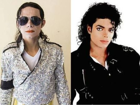 മൈക്കിള്‍ ജാക്‌സണാകാന്‍ മുഖത്ത് ആസിഡ് ഒഴിച്ചു