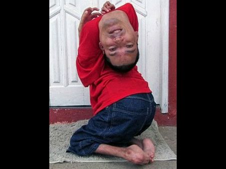 തലകീഴായി വളരുന്ന ഒരു മനുഷ്യനെ കാണൂ