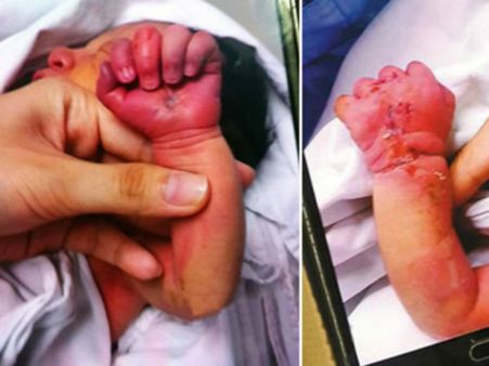 നവജാത ശിശുവിനെ തിന്നാന്‍ ശ്രമിച്ച അമ്മ അറസ്റ്റില്‍