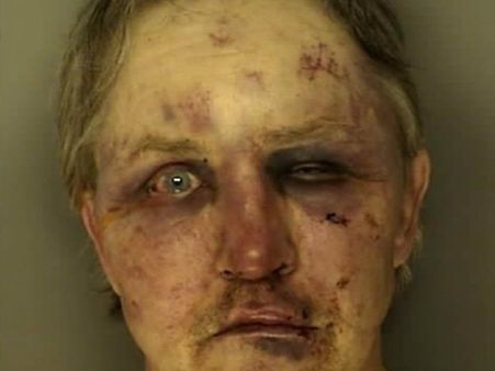 കാമുകിയെ ബലാത്സംഗം ചെയ്ത അമ്മാവനെ കാമുകന്‍ തല്ലി വിരൂപനാക്കി