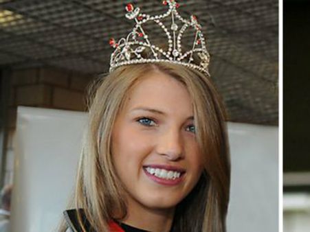 മോഡലിന്‍റെ പല്ല് ഇടിച്ച് തെറിപ്പിച്ചു, 800 പൗണ്ട് നഷ്ടപരിഹാരം